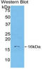 Protein S100-A6 antibody, LS-C303274, Lifespan Biosciences, Western Blot image 