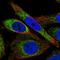 Zinc Finger Protein 467 antibody, NBP1-92626, Novus Biologicals, Immunofluorescence image 