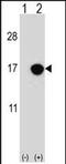 Cyclin Dependent Kinase Inhibitor 2B antibody, PA5-71734, Invitrogen Antibodies, Western Blot image 