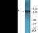 Insulin Receptor Substrate 1 antibody, EKC2048, Boster Biological Technology, Western Blot image 