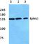 EPH Receptor A3 antibody, A02872, Boster Biological Technology, Western Blot image 