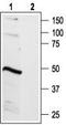 Bradykinin Receptor B2 antibody, TA328719, Origene, Western Blot image 