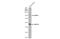 Oxysterol Binding Protein Like 1A antibody, GTX107722, GeneTex, Western Blot image 