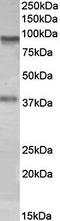 Amine Oxidase Copper Containing 3 antibody, orb167673, Biorbyt, Western Blot image 
