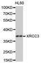 X-Ray Repair Cross Complementing 3 antibody, A2134, ABclonal Technology, Western Blot image 
