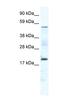 Casein Kinase 1 Gamma 1 antibody, NBP1-80262, Novus Biologicals, Western Blot image 