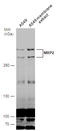 ATP Binding Cassette Subfamily C Member 2 antibody, GTX130181, GeneTex, Western Blot image 