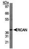 Regulator Of Calcineurin 1 antibody, TA309834, Origene, Western Blot image 
