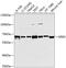 G Protein-Coupled Receptor Kinase 5 antibody, GTX64841, GeneTex, Western Blot image 