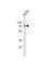 Suppression Of Tumorigenicity 7 Like antibody, abx034876, Abbexa, Western Blot image 