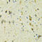 Solute Carrier Family 25 Member 11 antibody, 23-441, ProSci, Immunohistochemistry frozen image 