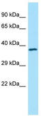 Tropomodulin 4 antibody, TA331237, Origene, Western Blot image 