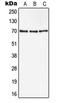 Endoglin antibody, LS-B14081, Lifespan Biosciences, Western Blot image 