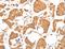 Acyl-CoA Synthetase Medium Chain Family Member 5 antibody, LS-C404428, Lifespan Biosciences, Immunohistochemistry paraffin image 