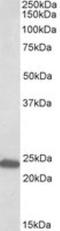 GM2 Ganglioside Activator antibody, NBP1-72045, Novus Biologicals, Western Blot image 