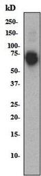 Ribosomal Protein S6 Kinase B1 antibody, ab32359, Abcam, Western Blot image 