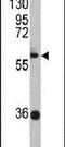 Zinc Finger And BTB Domain Containing 2 antibody, PA5-13708, Invitrogen Antibodies, Western Blot image 