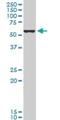 Forkhead Box C2 antibody, H00002303-M05, Novus Biologicals, Western Blot image 