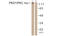 Serine/threonine-protein kinase D1 antibody, LS-C117817, Lifespan Biosciences, Western Blot image 