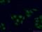 RNA Guanylyltransferase And 5'-Phosphatase antibody, 12430-1-AP, Proteintech Group, Immunofluorescence image 