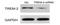 Triggering Receptor Expressed On Myeloid Cells 2 antibody, NBP1-22515, Novus Biologicals, Western Blot image 