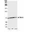 Menin 1 antibody, NB100-215, Novus Biologicals, Western Blot image 