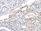 Twinfilin Actin Binding Protein 2 antibody, LS-C404630, Lifespan Biosciences, Immunohistochemistry frozen image 