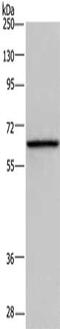 Dopamine Beta-Hydroxylase antibody, CSB-PA958803, Cusabio, Western Blot image 