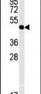 Interleukin 5 Receptor Subunit Alpha antibody, PA5-25159, Invitrogen Antibodies, Western Blot image 