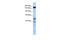 Zinc Finger Protein 335 antibody, 25-529, ProSci, Western Blot image 