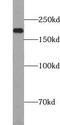 Terminal Uridylyl Transferase 4 antibody, FNab09609, FineTest, Western Blot image 