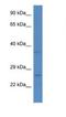 Coiled-Coil-Helix-Coiled-Coil-Helix Domain Containing 6 antibody, NBP1-79819, Novus Biologicals, Western Blot image 