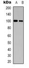Centrobin, Centriole Duplication And Spindle Assembly Protein antibody, LS-C368696, Lifespan Biosciences, Western Blot image 