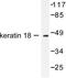 Keratin 18 antibody, LS-C176095, Lifespan Biosciences, Western Blot image 