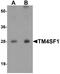 Transmembrane 4 L6 family member 1 antibody, A10368, Boster Biological Technology, Western Blot image 