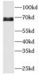 Mbt Domain Containing 1 antibody, FNab05044, FineTest, Western Blot image 