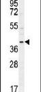 Cyclin G1 antibody, PA5-24422, Invitrogen Antibodies, Western Blot image 