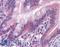 Gasdermin D antibody, LS-B4537, Lifespan Biosciences, Immunohistochemistry paraffin image 