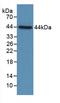 Complement Component 4B (Chido Blood Group), Copy 2 antibody, LS-C663516, Lifespan Biosciences, Western Blot image 