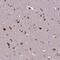 Immunoglobin Superfamily Member 21 antibody, PA5-60740, Invitrogen Antibodies, Immunohistochemistry frozen image 