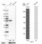 Keratin 13 antibody, HPA030877, Atlas Antibodies, Western Blot image 