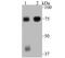 Engulfment And Cell Motility 1 antibody, A03091-1, Boster Biological Technology, Western Blot image 