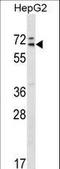 Mediator of RNA polymerase II transcription subunit 26 antibody, LS-C164120, Lifespan Biosciences, Western Blot image 