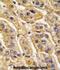 3-Hydroxyisobutyryl-CoA Hydrolase antibody, abx033393, Abbexa, Immunohistochemistry paraffin image 