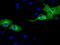 Adenylate Kinase 5 antibody, LS-C115591, Lifespan Biosciences, Immunofluorescence image 