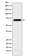 IKAROS Family Zinc Finger 3 antibody, M01611-2, Boster Biological Technology, Western Blot image 