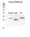 Potassium Voltage-Gated Channel Interacting Protein 3 antibody, A03700S63, Boster Biological Technology, Western Blot image 