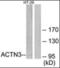 Actinin Alpha 3 (Gene/Pseudogene) antibody, orb93595, Biorbyt, Western Blot image 
