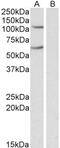 Wnt Family Member 9B antibody, 42-099, ProSci, Enzyme Linked Immunosorbent Assay image 