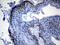 Colony Stimulating Factor 3 antibody, LS-C798843, Lifespan Biosciences, Immunohistochemistry paraffin image 